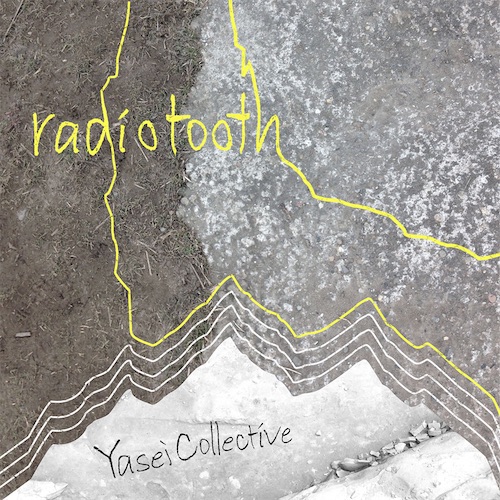 radiotooth